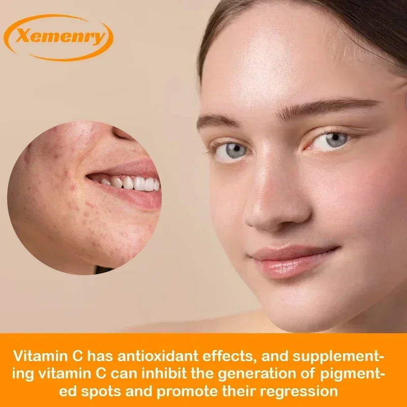 Vitamin C Capsules 1000mg - Im - Zinc Supplement 50Mg 评论和价格